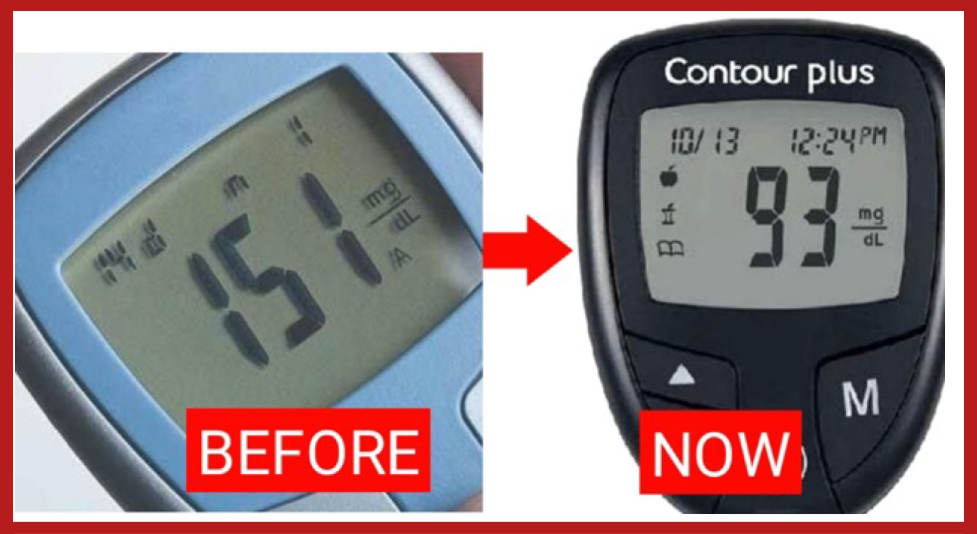 Diabetes